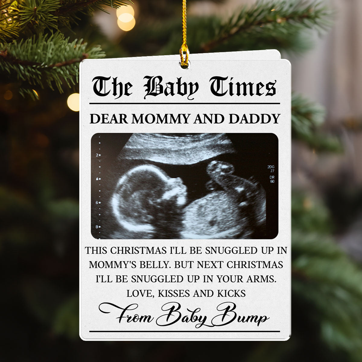 The Baby Times - Personalized Custom Acrylic Ornament