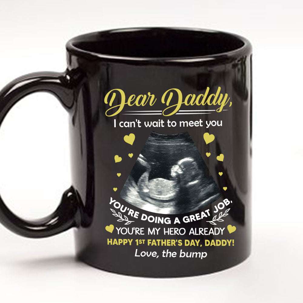 Cant Wait To Meet You - Personalized Custom Coffee Mug