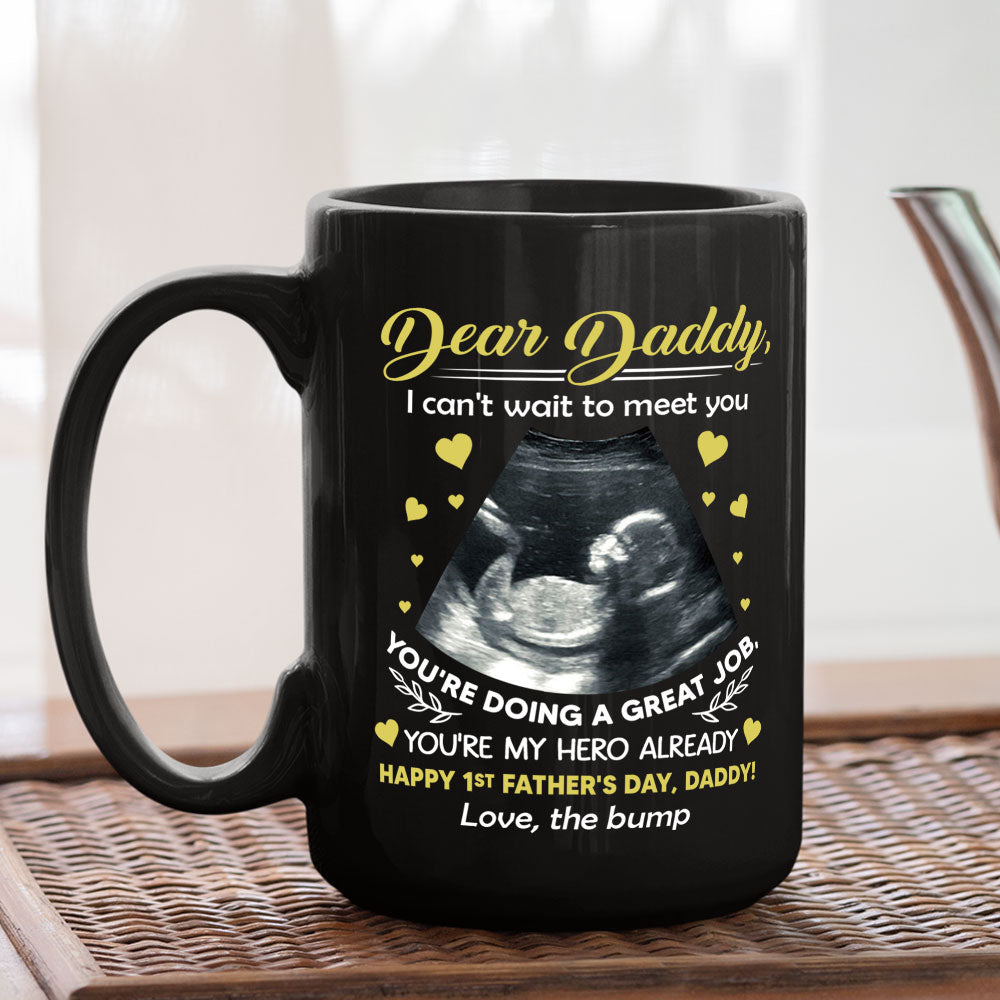 Cant Wait To Meet You - Personalized Custom Coffee Mug