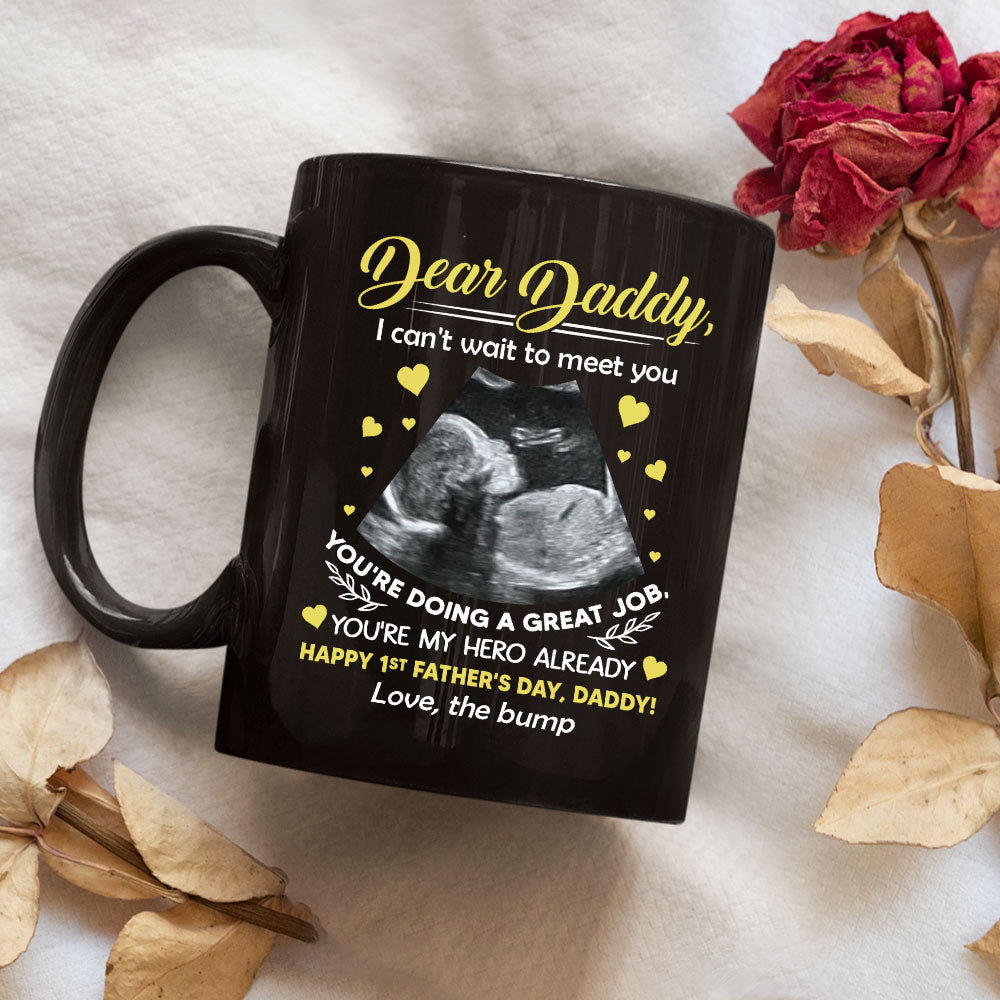 Cant Wait To Meet You - Personalized Custom Coffee Mug
