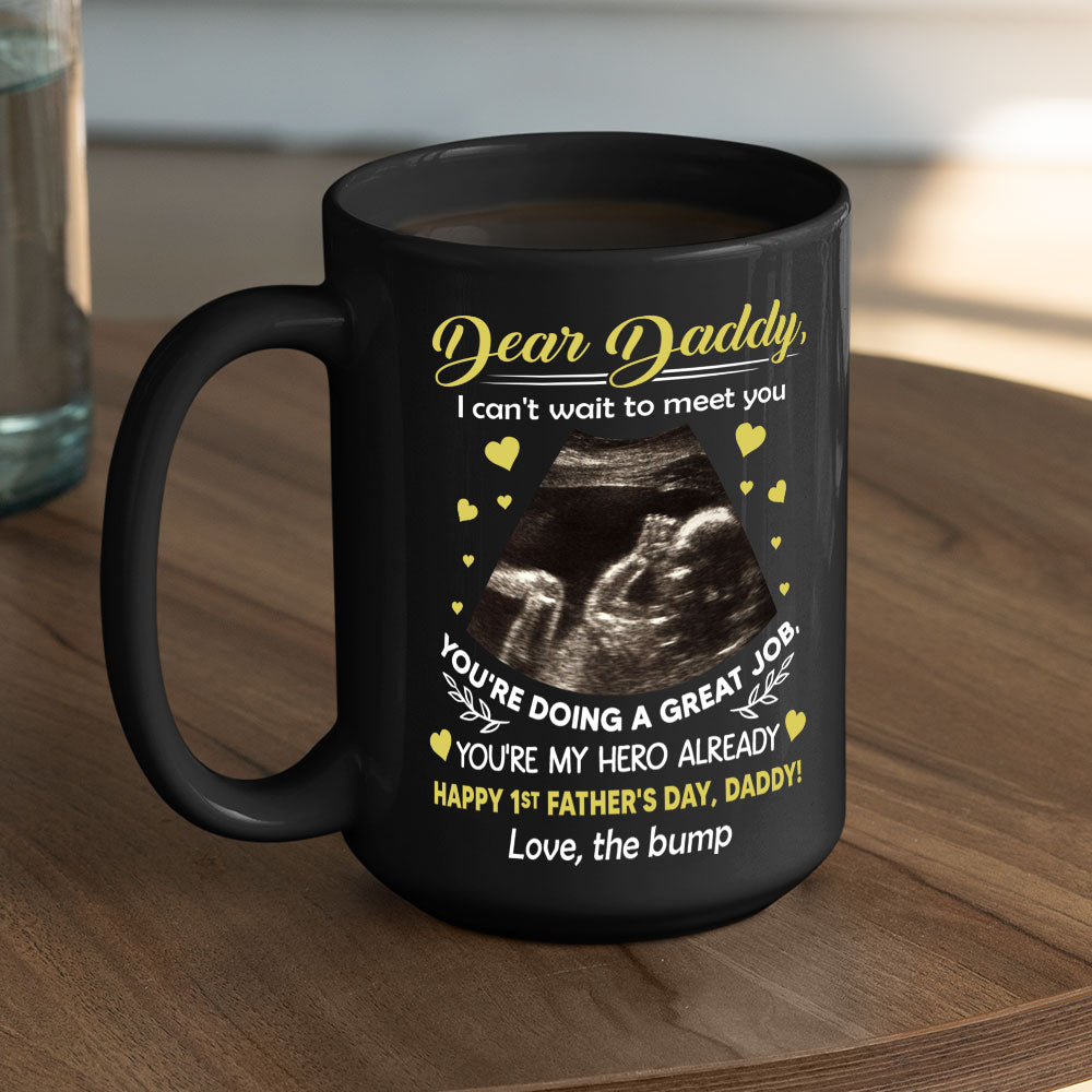 Cant Wait To Meet You - Personalized Custom Coffee Mug