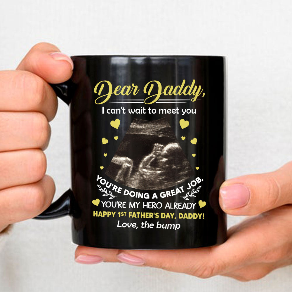 Cant Wait To Meet You - Personalized Custom Coffee Mug