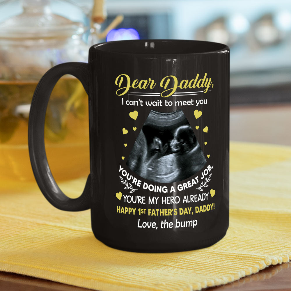 Cant Wait To Meet You - Personalized Custom Coffee Mug